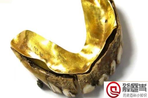 200年前黄金假牙是怎么回事?现在价值多少估价多少钱?