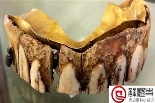 200年前黄金假牙是怎么回事?现在价值多少估价多少钱? 200年前黄金假牙是怎么回事?现在价值多少估价多少钱?