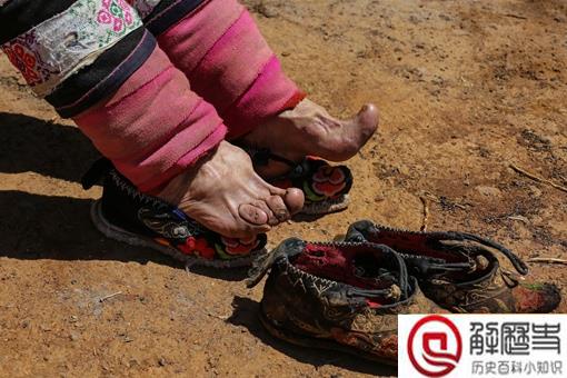 裹小脚是为了缩阴吗