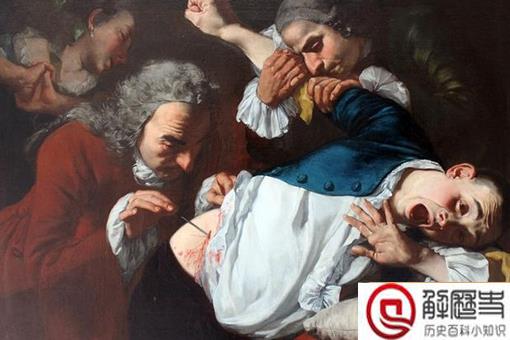 古代人得了阑尾炎会怎么办 古人得了阑尾炎是不是就痛死了 古代人得了阑尾炎会怎么办 古人得了阑尾炎是不是就痛死了