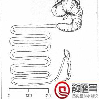 古代人得了阑尾炎会怎么办 古人得了阑尾炎是不是就痛死了