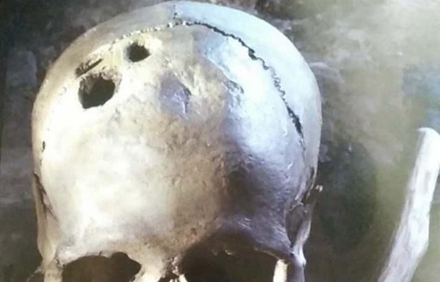 华佗被曹操杀原因是因为华佗太耿直? 华佗被曹操杀原因是因为华佗太耿直?