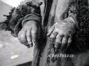 手游现731部队是怎么回事?731部队历史事件揭秘