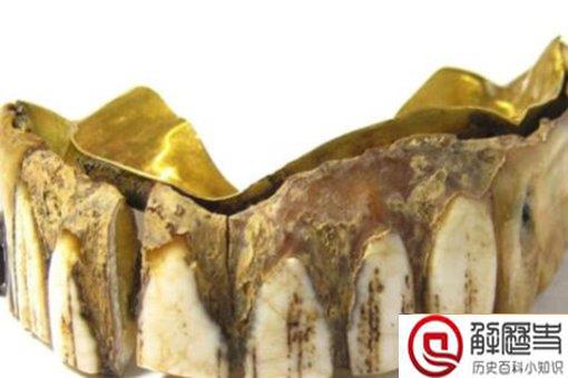 200年前黄金假牙是怎么回事?现在价值多少估价多少钱?