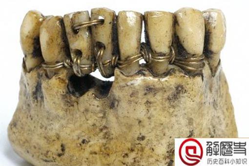 古代人的假牙使用什么做的?揭秘古代一些奇葩的事实