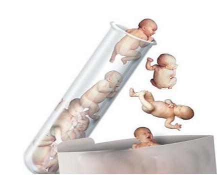 1998年11月24日 上海首对龙凤胎试管婴儿诞生